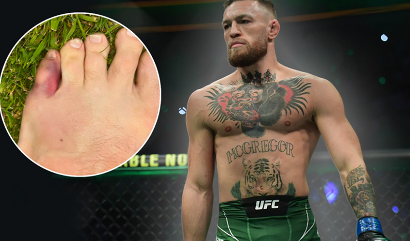 conor mcgregor spasmeno daxtylo