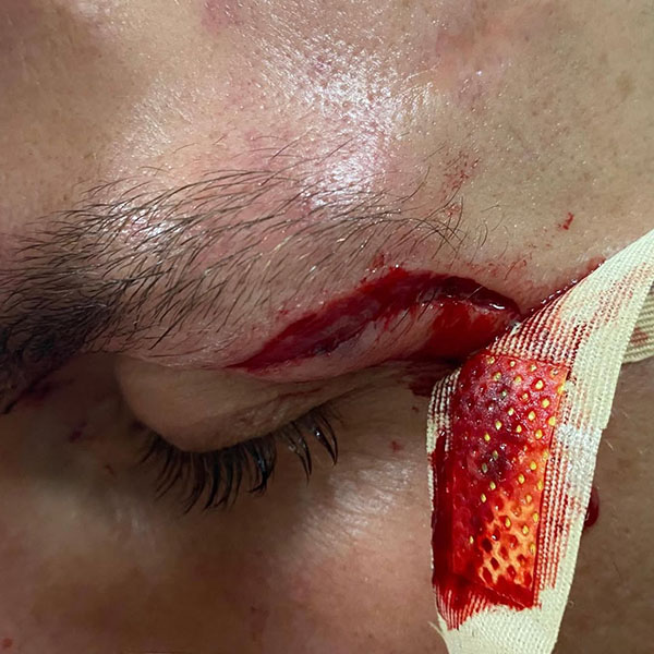 malichoudis cullhaj 8