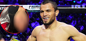 umar nurmagomedov broken hand 9 small