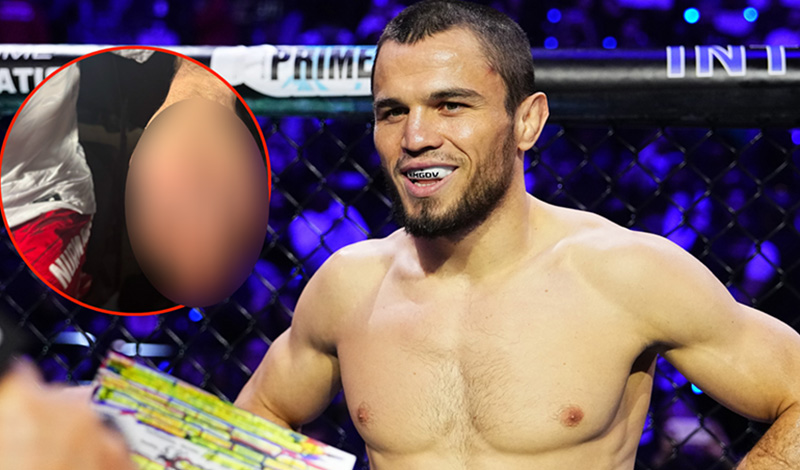 umar nurmagomedov broken hand 9